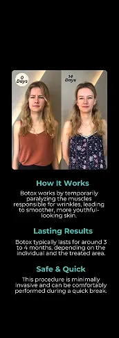 Botox Email Flat Fee 03