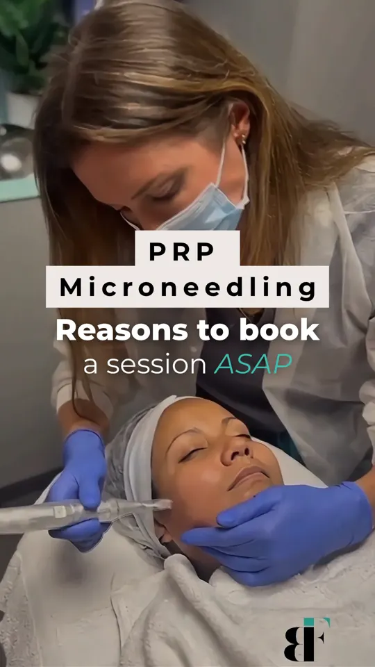 Microneedling Ad PRP Reasons To Book Cover Image