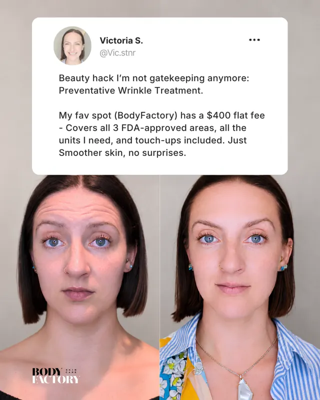 Botox Ad Campaign3x4 01