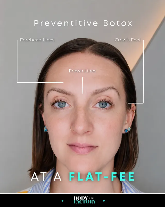 Botox Ad Campaign3x4 07