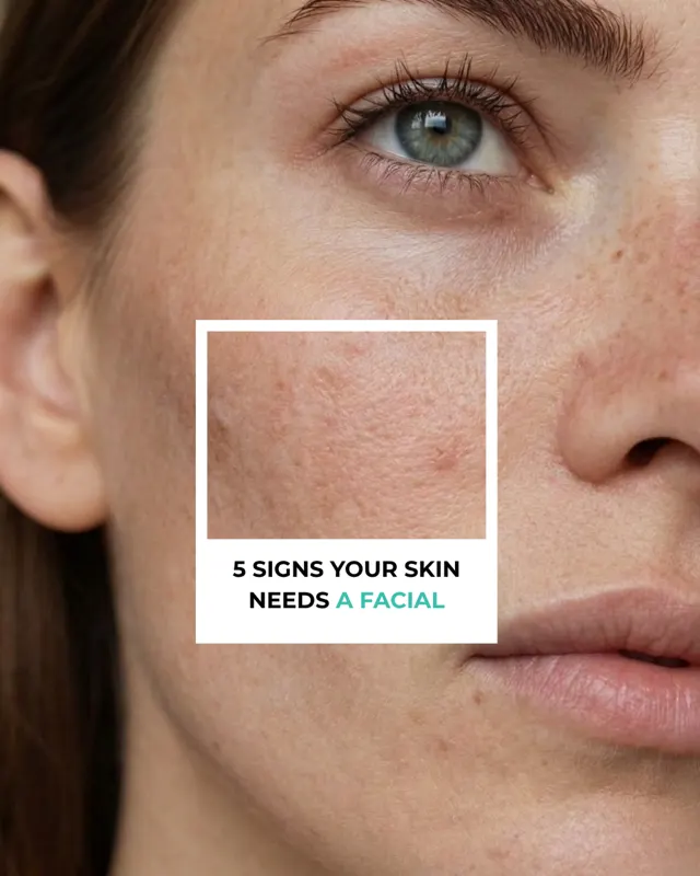 Brand Social Skin Types Carousel 01