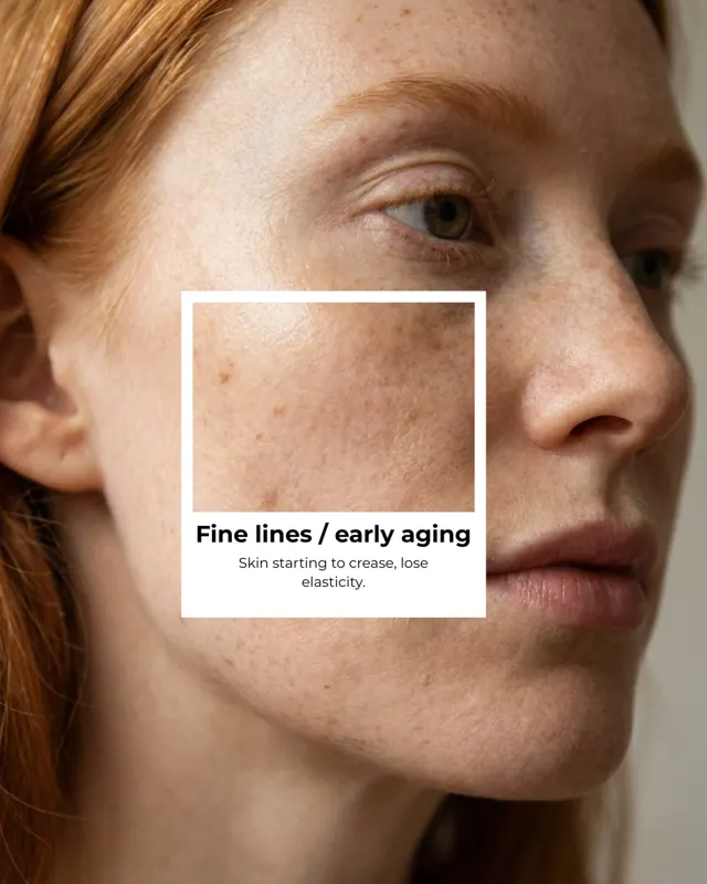 Brand Social Skin Types Carousel 10