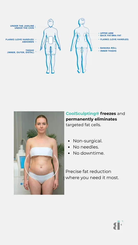 Cool Sculpting Social Carousel 03