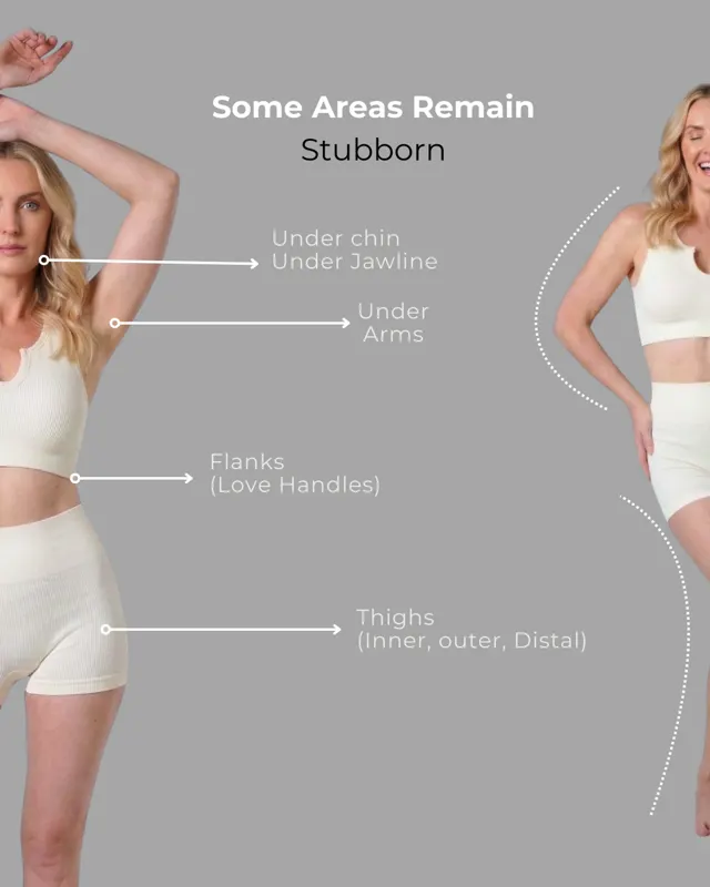 Cool Sculpting Social GLP1Weight Loss Panel 02