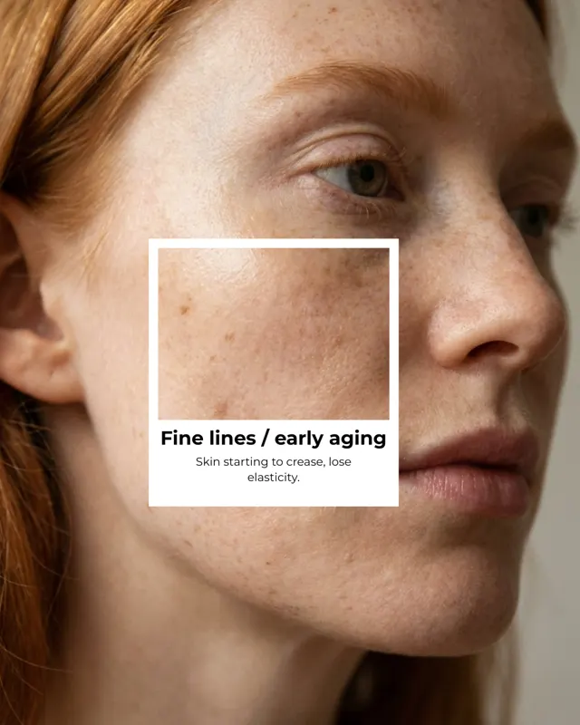 Hydra Facial Social 5Signs Carousel 10
