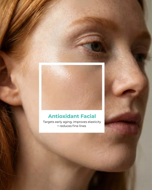 Hydra Facial Social 5Signs Carousel 11