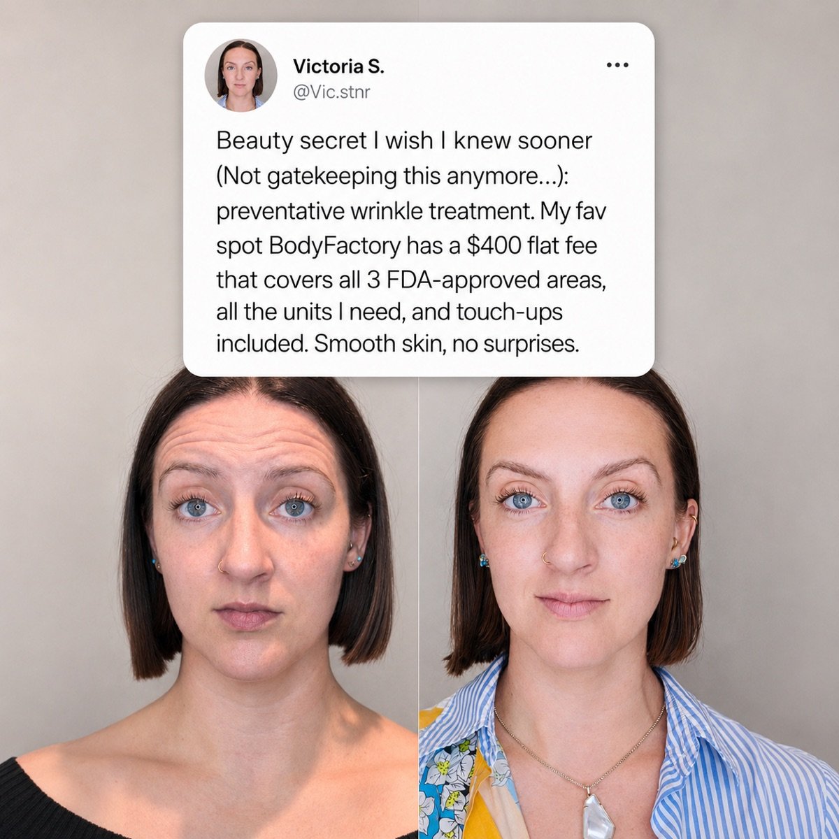 Meta Ads Collection cover image
