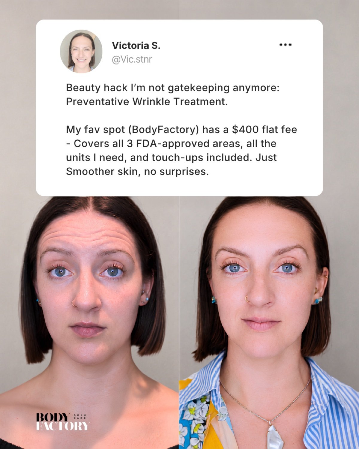 Wrinkle Treatmemt Campaign 3X4 cover image