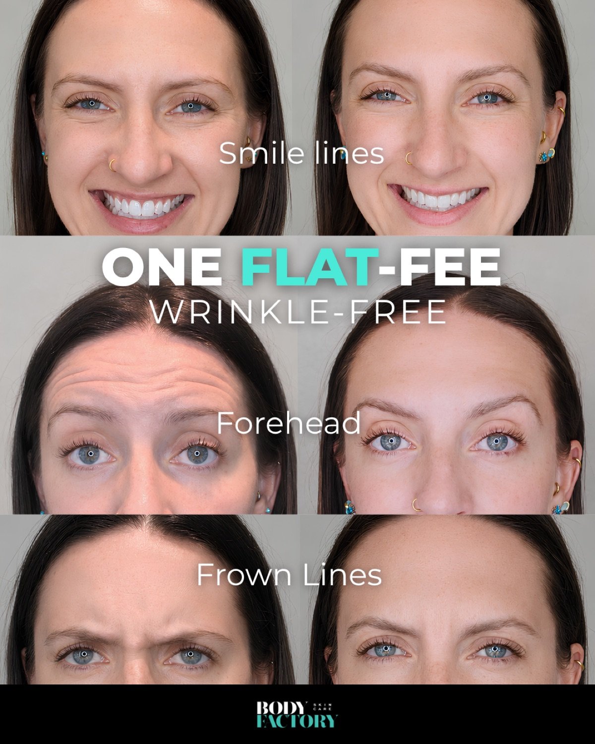 Meta Ads Collection, 5