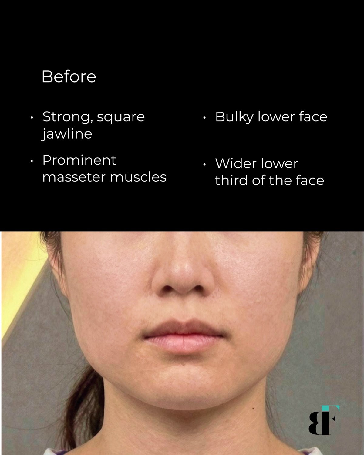 BodyFactory Instagram, Instagram Post - 40